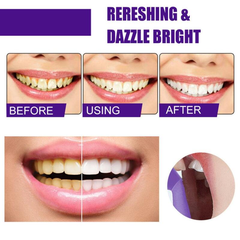 Lot зубной мусс для отбеливания зубов эффективно удаляет желтый зубной налет, пятна от дыма, очищает зубы, освежает дыхание