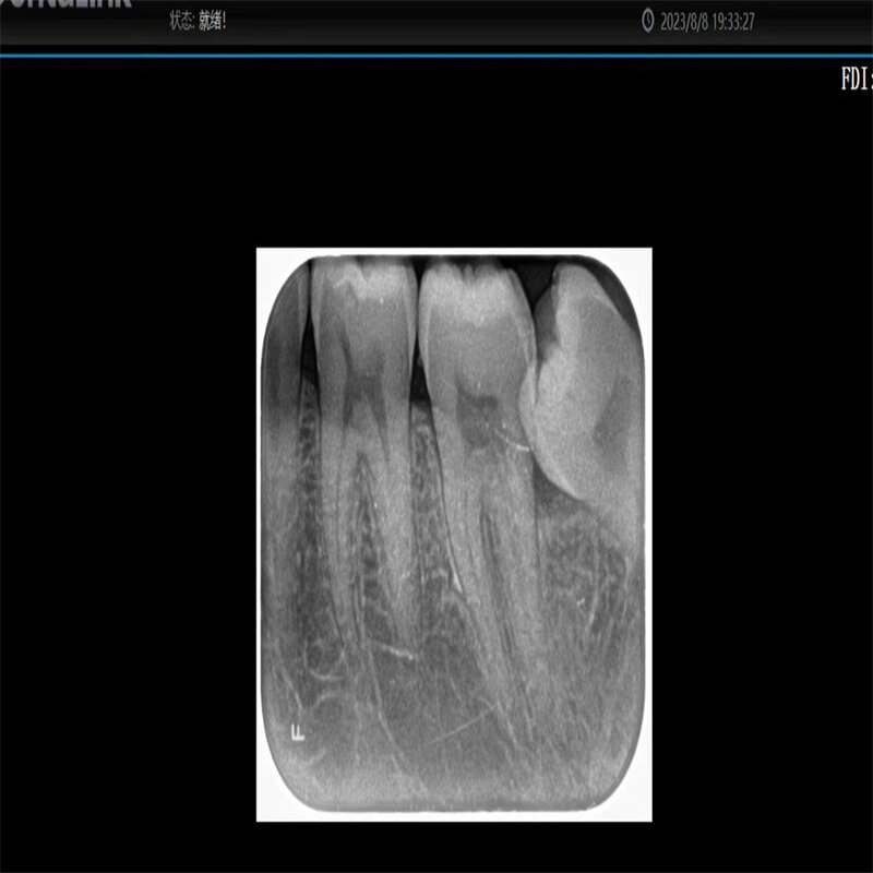 Equipamento dental da máquina do raio x de alta frequência sem fio handheld x ray unidade ferramentas odontológicas instrumentos dicas