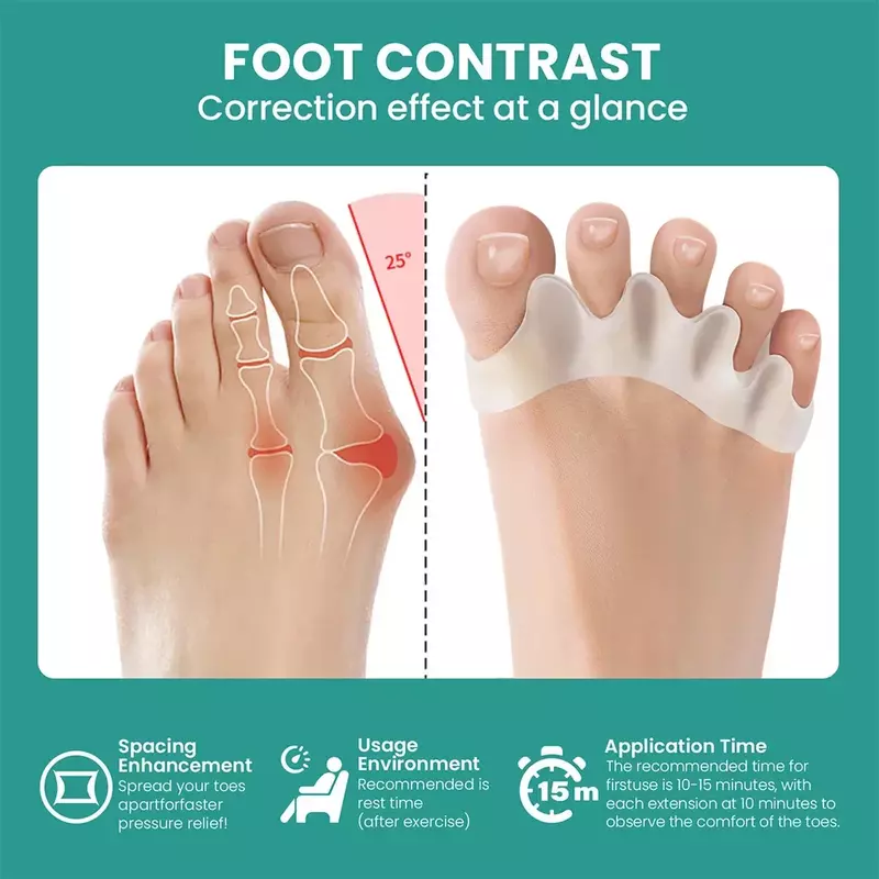 1 para silikonowy korektor Separator palców stopy korektor palec młotowaty miękki silikonowy materiał do narzędzie do pielęgnacji stóp separacji palców