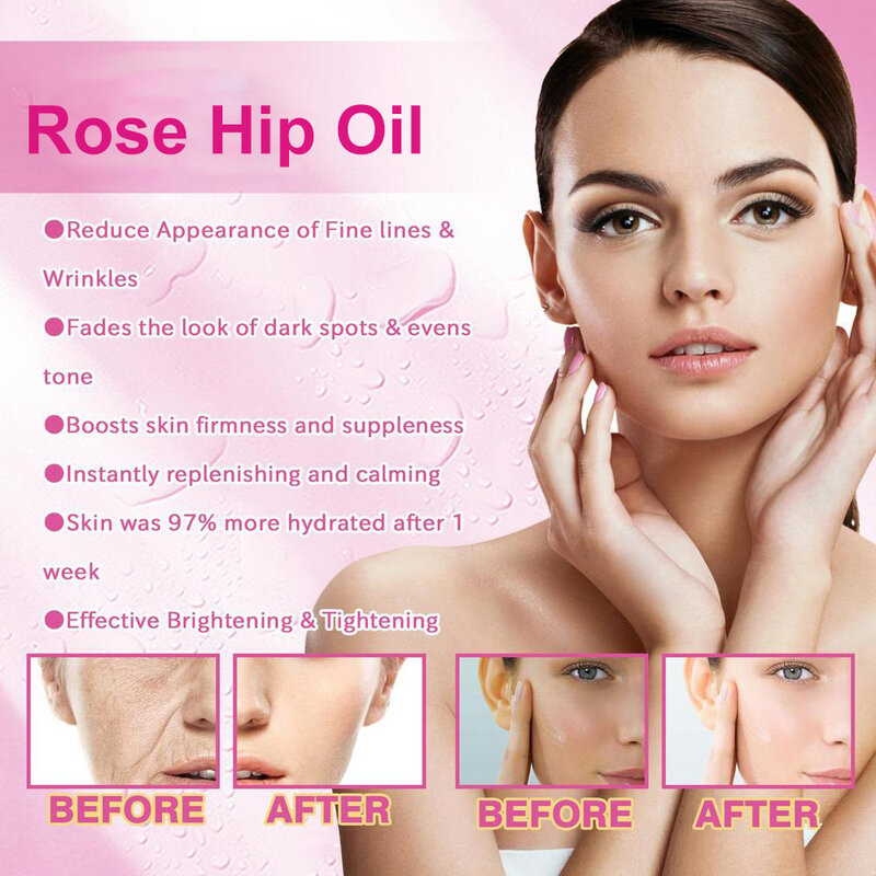 100ml Natural Organic Rose Hip Oil Massage olio per viso e corpo rilassante idratante idratante miglior prodotto per il controllo della cura della pelle