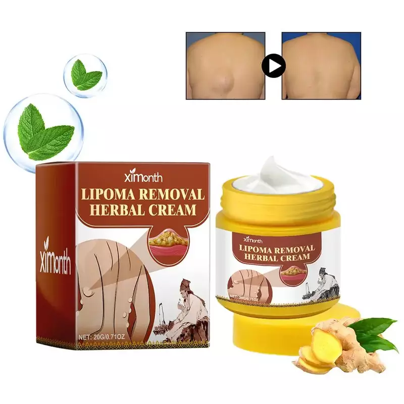 Lipooma Verwijdering Kruidencrème Bodycreme Oplossend Vet Gemakkelijk Te Gebruiken Kruidenlipoomverwijderingscrème