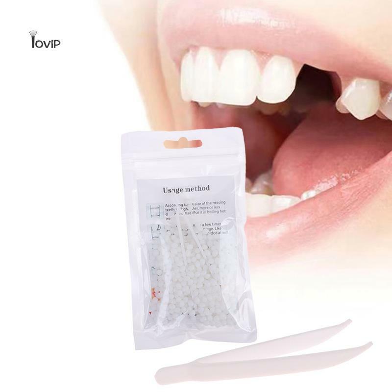 Kit perbaikan rongga pengisian gigi sementara, Gigi hilang rongga celah gigi padat bahan gigi tiruan semen