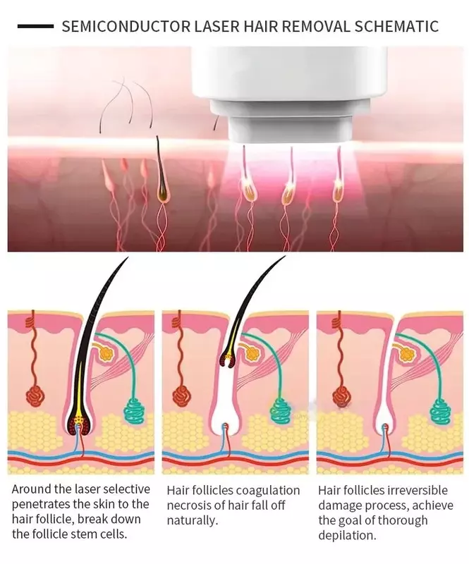 Máquina de depilação a laser de diodo para mulheres, poder profissional, axilas, biquíni, rejuvenescimento da pele, depilador de salão, 2024