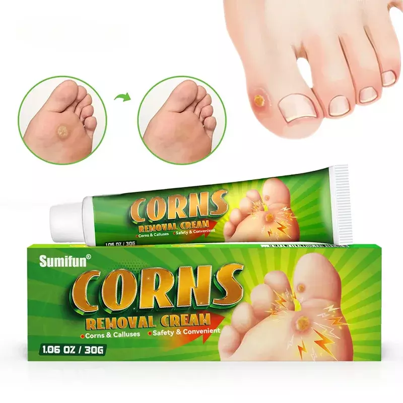 Foot Corn Remover Cream Chicken Eye Skin Infection Treatment Ointment Feet Dead Skin Calluses Removal Tool Health Care