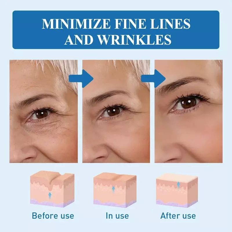 Eye cream Remove bags Puffiness away work under eyes