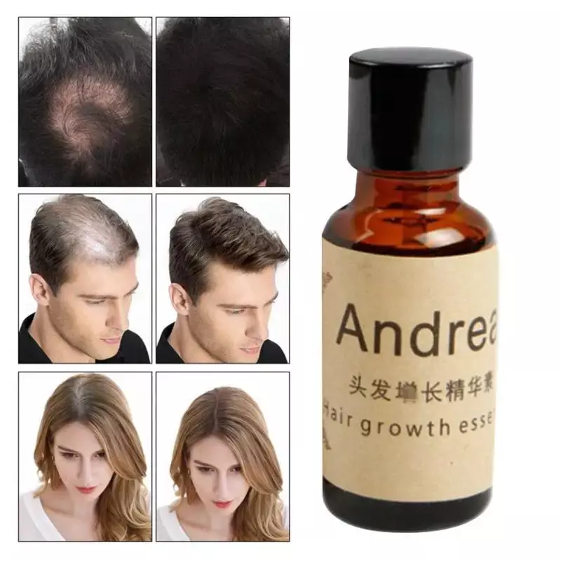 20Ml Huile Essentielle น้ำมันหอมระเหย Andrea Hair Growth ผมร่วง Liquid Grow การฟื้นฟู Pilatory หนาแน่น Fast Sunburst