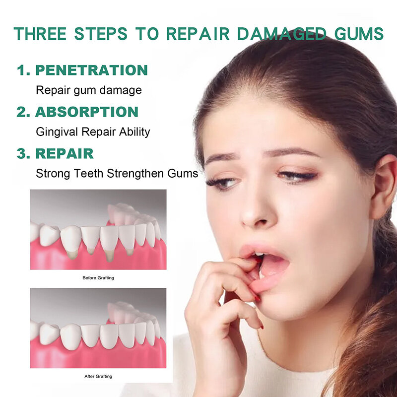 Gotas de rebrota da gengiva periodontal Gotas bucais, tratamento da dor, mau hálito, antibactérias, cuidados orais limpos, lua sul, 30ml, 1pc