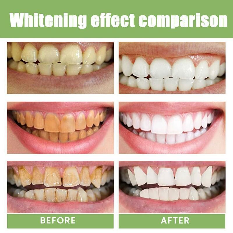 Natural Mint Flavor Teeth Whitening Essence Oral Care Cleaning Ampoule Serum Remove Teeth 15ml Effective Toothpaste Stains E4N0