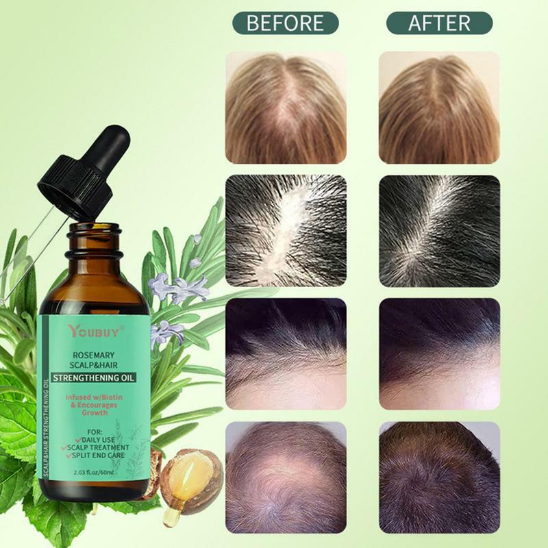 Aceite Esencial de Romero para el cuidado del cabello, suero suave Antifrizz, productos en aerosol para el crecimiento rápido del cuero cabelludo, nuevos tratamientos para el cuidado del cabello