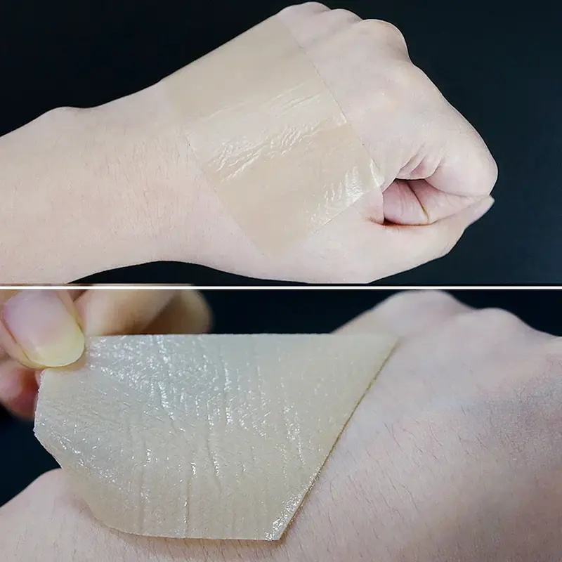 Gel silikon penghilang bekas luka, perawatan perbaikan kulit pita perekat diri 15-150cm untuk mengurangi bekas luka jerawat