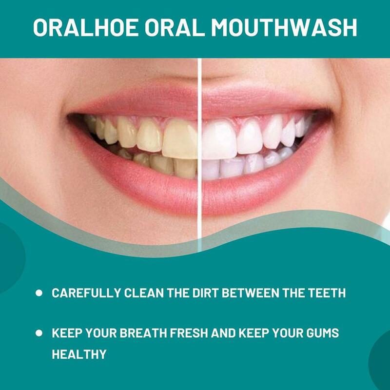 Dentes Limpeza Mousse, Remover manchas de placa Respiração, Reparação Gengival, Clareamento Fresco, Espuma Oral, Higiene Dentária, Ca E8M4