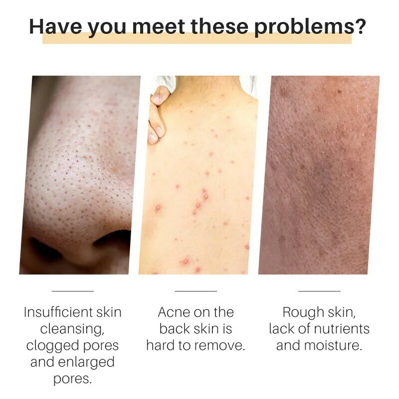 Huile essentielle anti-acné faite à la main pour le corps, nettoyant pour le visage, élimine les boutons et les taches sombres, éclaircissant la peau, curmeric VideoRegina, bain corporel, 100g