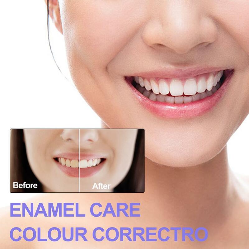 5 stücke Zahn aufhellung Zahnpasta Emaille Zähne Flecken entfernung Pflege Zahn farbe Mousse Erfrischer Zahn Mundhygiene Reinigung Corre