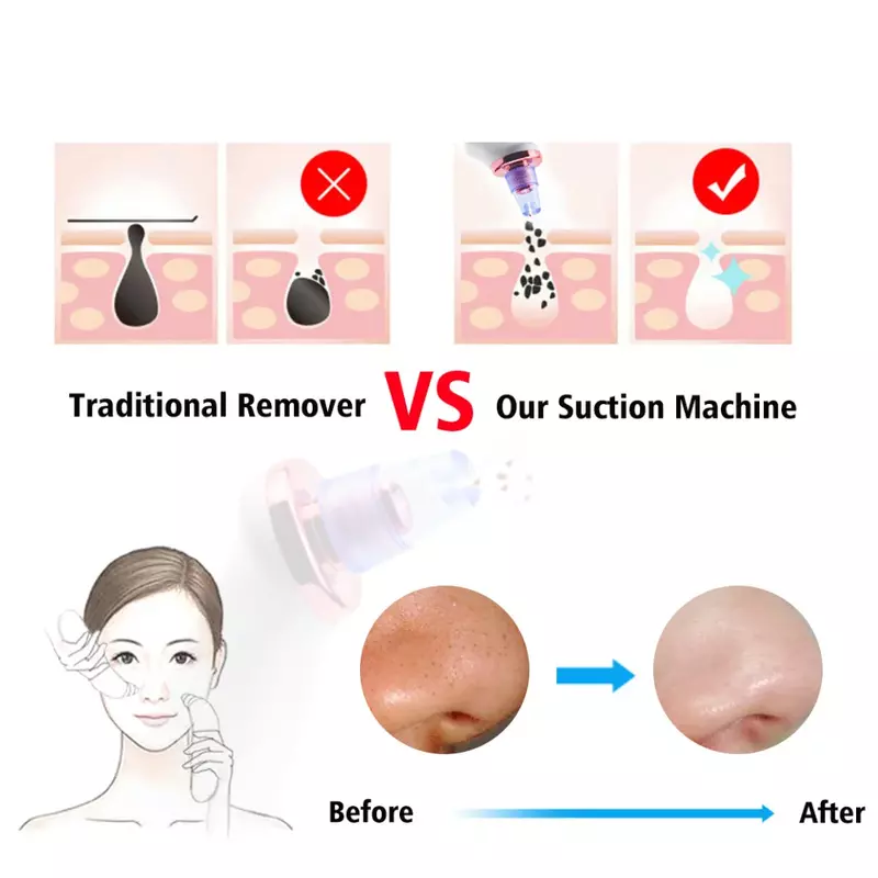 Próżniowe urządzenie oczyszczające pory usuwająca zaskórniki elektryczne trądzik zaskórników skazy usuwają złuszczające oczyszczające przyrząd kosmetyczny twarzy