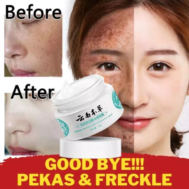 Melasma Cream Pekas Remover Original Collagen Pekas Freckles Remover Freckle Skin Whitening Cream