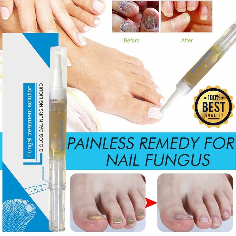 Anti Fungal Unhas Tratamento Líquido Pen, Solução de Reparação, Óleo Nutritivo, Adequado para Dedo, Skinny, Toe, Finger Care, Fungo, Restaura Saudável