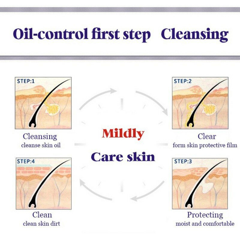 Bioaqua-limpador facial, tratamento da acne, cravo, limpador de pele, rosto limpo, removedor de acne, cuidados com o rosto, novo