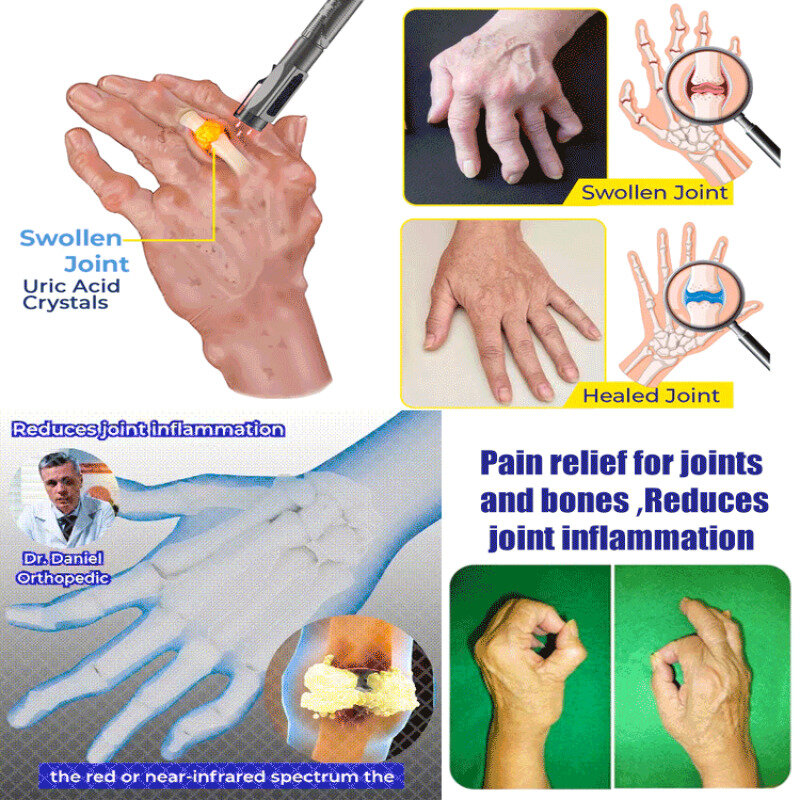 Aparatos de cuidado de articulaciones, bolígrafo médico ligero, luz blanca y amarilla