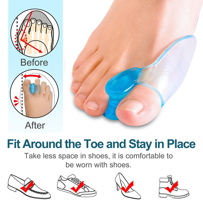 Corretor transparente do polegar azul, Separador macio do toe do gel do silicone, Espaçadores dos pés, Ferramenta do cuidado do pé