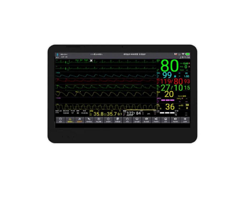 CONTEC-Monitor de Sinais Vitais, Monitor de Pacientes ICU, Touch Color LCD, 6 Parâmetros, 14 ", CMS8500