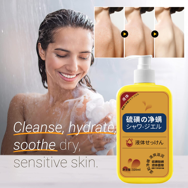 Enxofre líquido ácaro remoção Sabão Shower Gel limpeza profunda corpo inteiro Acne Body Wash