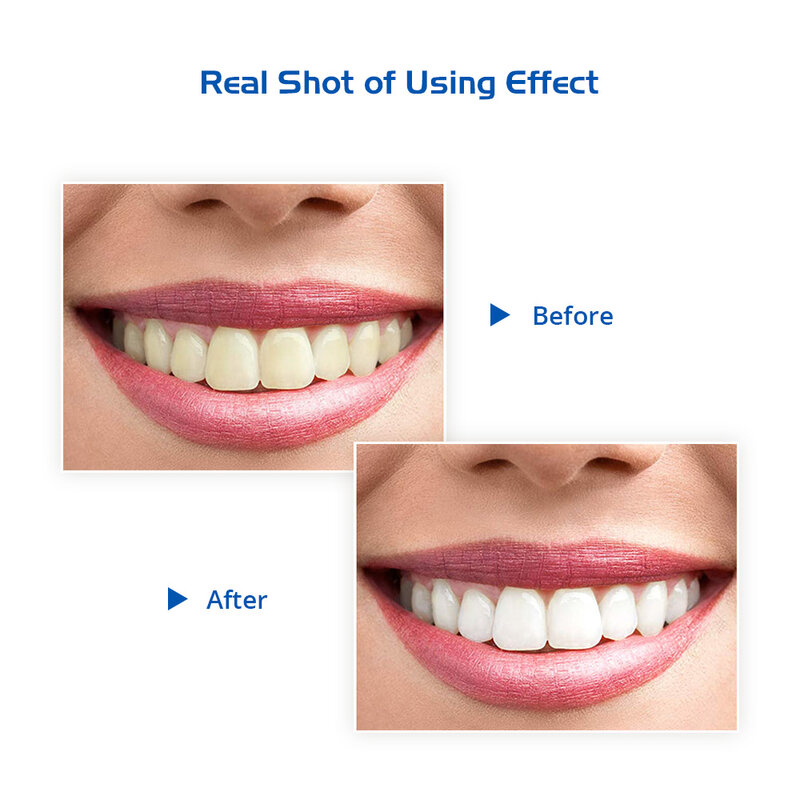 Teeth Whitening Strips Oral Hygiene Care Mint Whitening Dental Bleaching Tools Teeth Strips Kit
