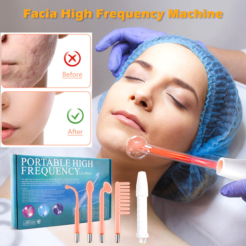 Eletrodo portátil de alta frequência máquina da beleza facial eletroterapia varinha tubo vidro rosto limpeza pele aperto dispositivo