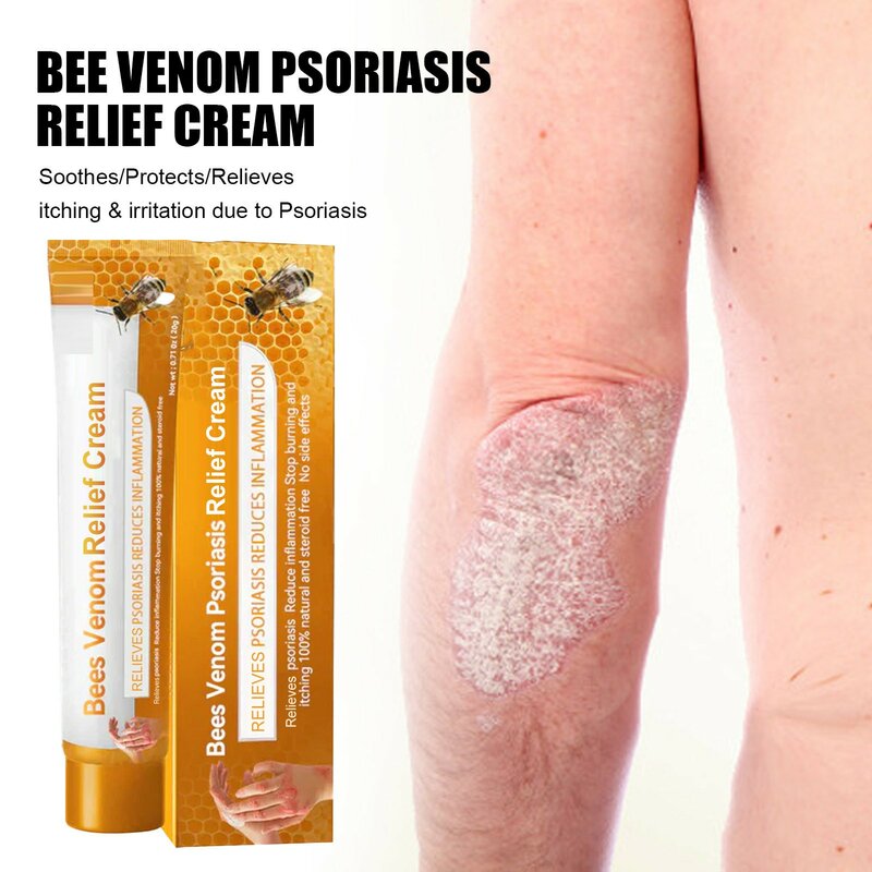 20g Body Skin Care Ointment Bees Venoms Anti-Itch Paste Body Ointment Moisturizer Dry Sensitive Hand Desquamation Ointment