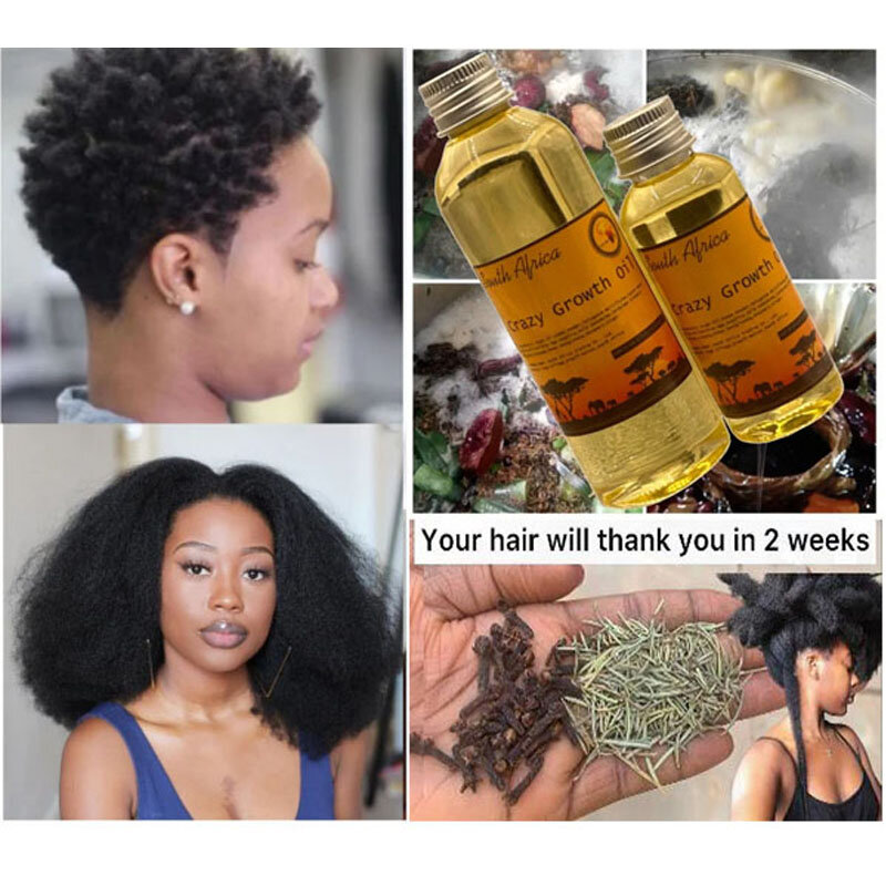 African Traditional Handmade Crazy Growth Oil Only 10-30 ml GROW YOUR HAIR FASTER LONGER IN TWO WEEKS