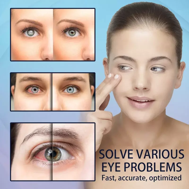 Gota de ojos para mejorar la vista, protección para aliviar la fatiga ocular, picazón seca, rojeces, incomodidad de visión borrosa, SOLUCIÓN DE CUIDADO HIDRATANTE