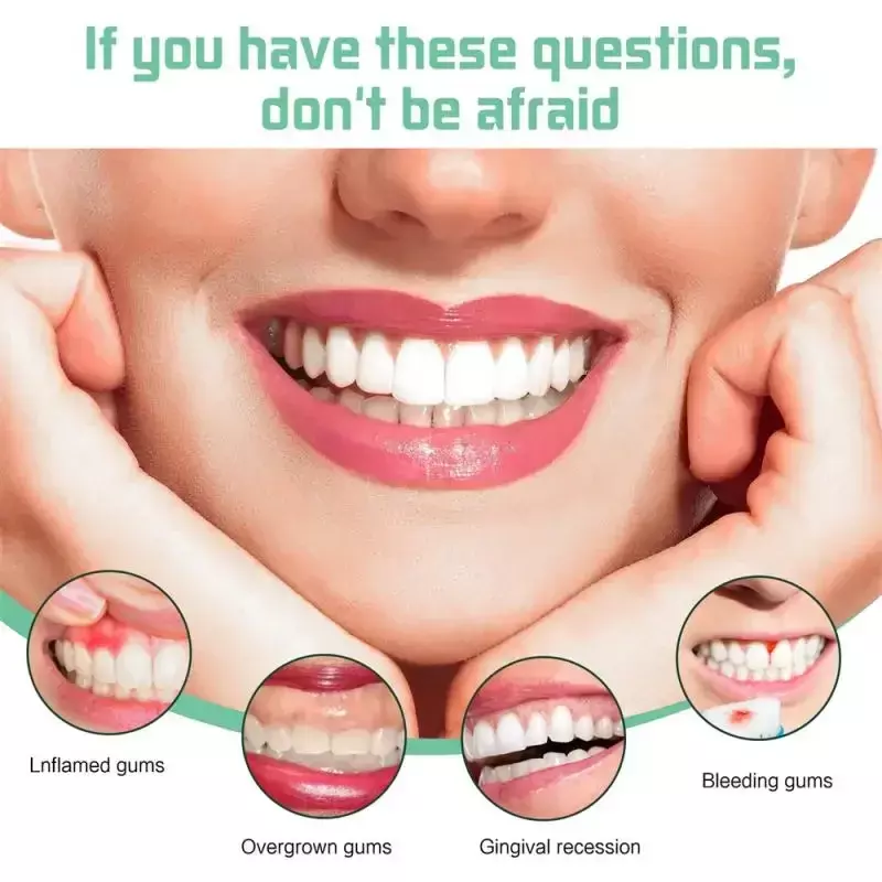 Suero de reparación rápida de encías, blanqueador dental, elimina el crecimiento de las encías, gotas orales naturales, alivia la caída de las encías, el dolor de dientes