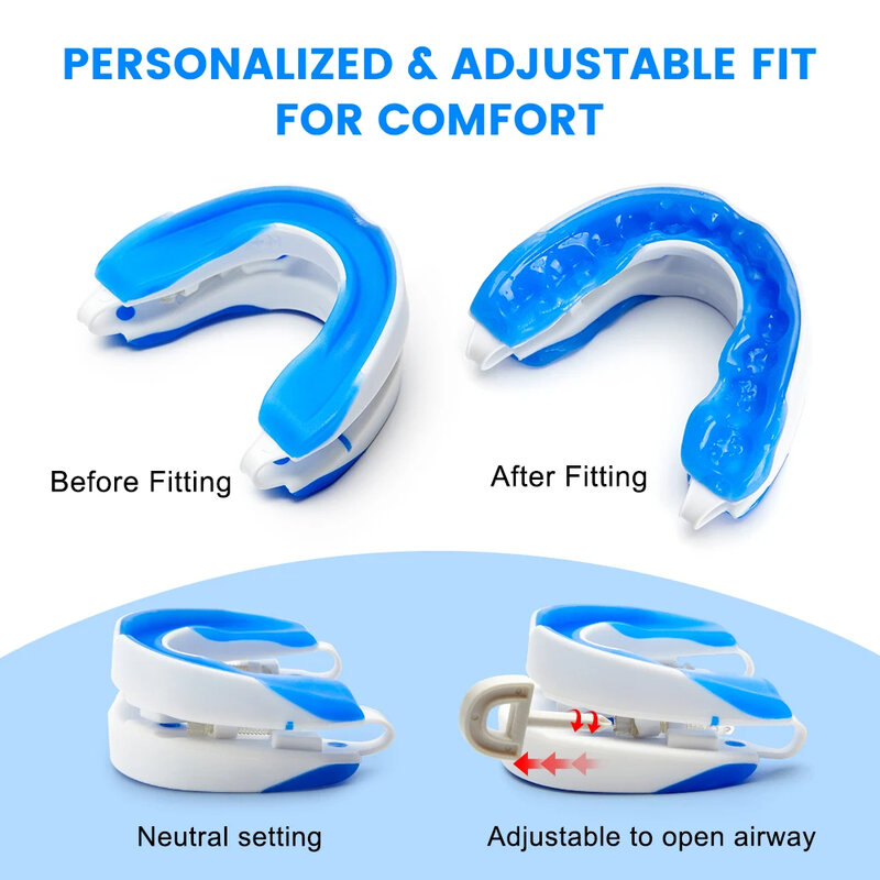 Protector bucal antirronquidos ajustable, dispositivos antirronquidos para dormir, tapón para ronquidos, mejora el sueño, boquilla para ronquidos