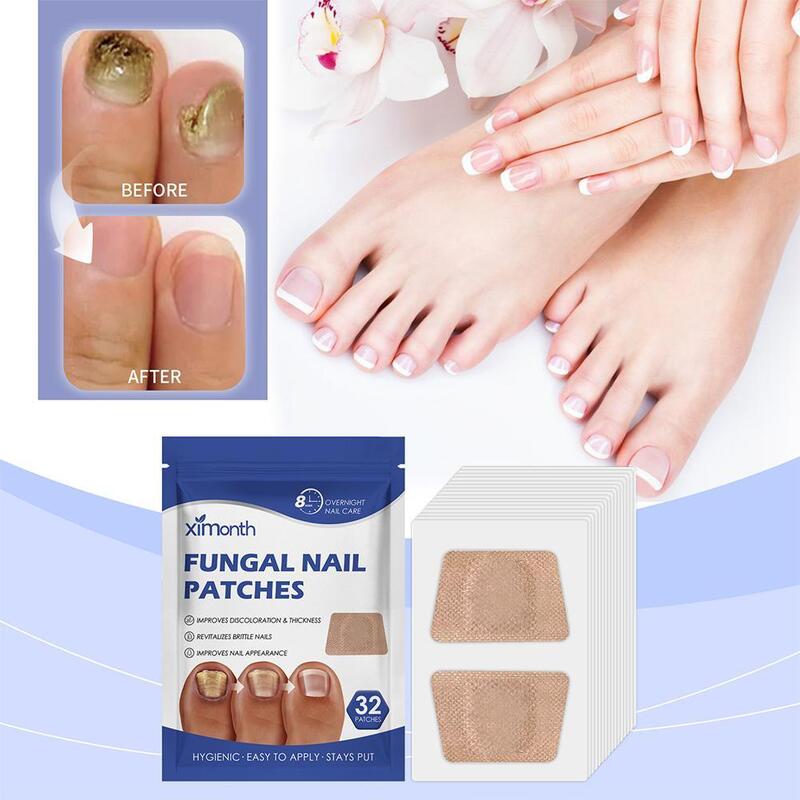 32 łatki/opakowanie plaster grzybicy paznokci lepkie łatki do naprawy paznokci wrośnięte naklejki korekcyjne do odbarwionych lub uszkodzonych paznokci