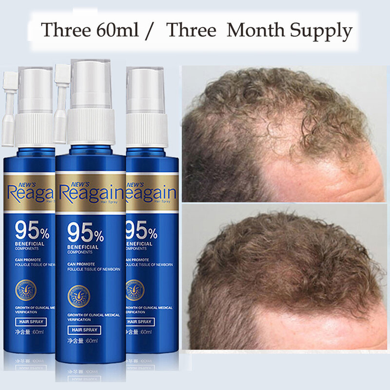 Spray de croissance des cheveux pour femmes et hommes, traitement anti-chute de cheveux, barbe, essence de croissance des yeux, réparation des racines des cheveux endommagées, 3 pièces