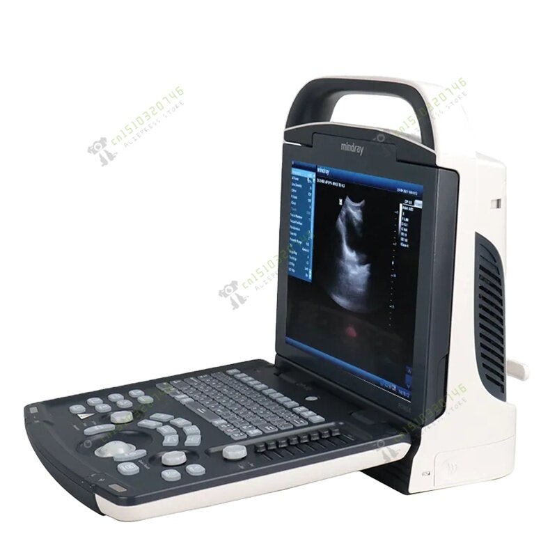 Mindray-Máquina portátil do ultrassom, DP 10, portátil