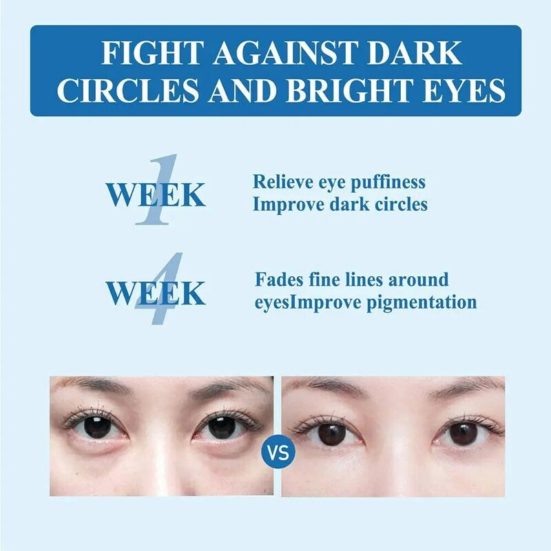 Frauen Augen creme entfernen Taschen Schwellungen weg Arbeit unter aufhellen Anti-Falten aufhellen Creme Augen reparieren feine Linien Auge s5c3