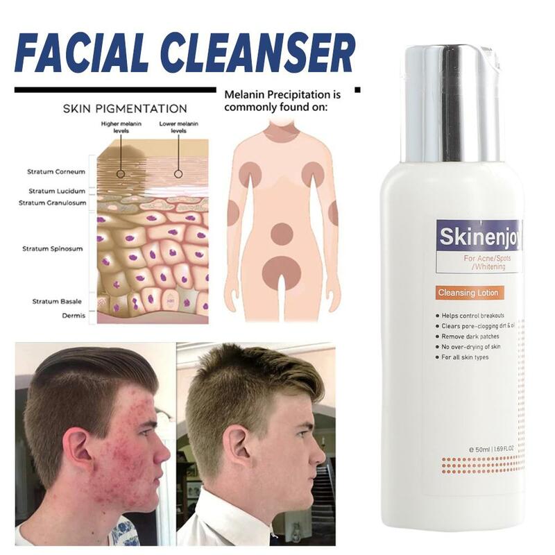 Limpiador Facial de espuma para el cuidado de la piel, limpiador Facial hidratante para eliminar puntos negros, reducir los poros, Limpieza Profunda, Control de aceite, blanqueamiento