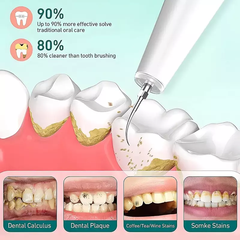 Elektrischer Zahnent kalker Ultraschall elektrischer Zahnstein Zahnstein entferner Plaque entfernung Haushalts zahn reiniger Fleck Zahn polieren