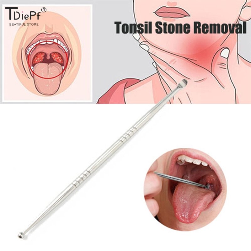 1 buah Tonsil penghilang batu telinga, alat penghilang lilin telinga baja tahan karat, alat perawatan pembersih mulut, penghilang batu Tonsil, perawatan kesehatan