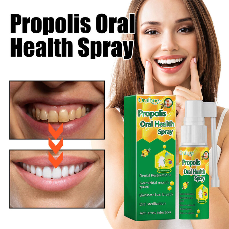 Semprotan kesehatan mulut Propoliss portabel, 1/2/3 buah 20ml mudah digunakan untuk penggunaan sehari-hari peralatan perawatan mulut