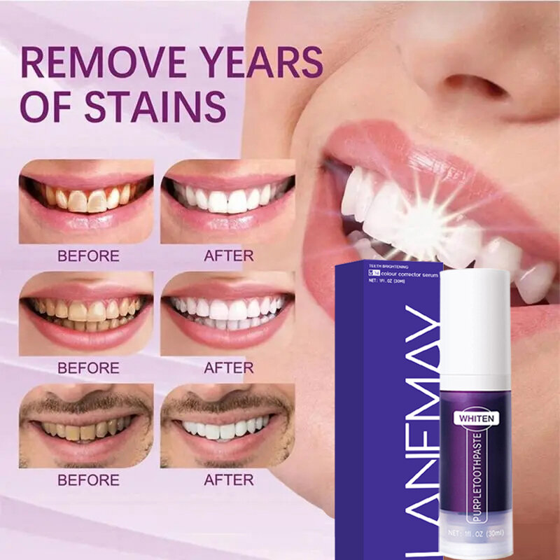 V34 Purple Whitening Toothpaste, Remoção de manchas dentárias Limpeza, Higiene Oral, Branqueamento Dental Tools, Fresh Breath Tooth Care, 30ml