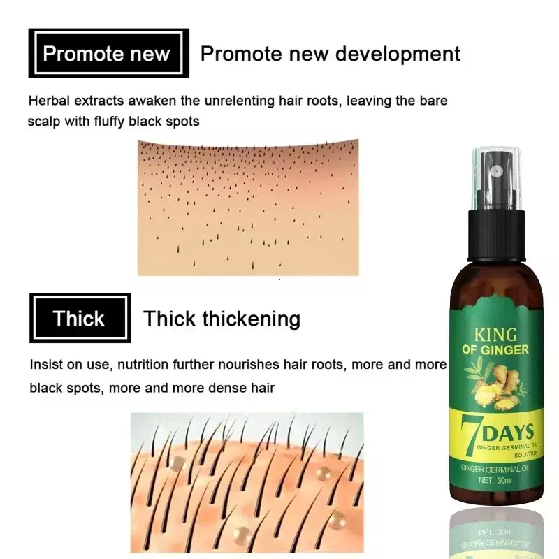 Ingwer Haarwuchs Spray Massage Kopfhaut stärkt dichtes Haar verhindert Haarausfall Stärkung-Haar reparatur pflegende Flüssigkeit
