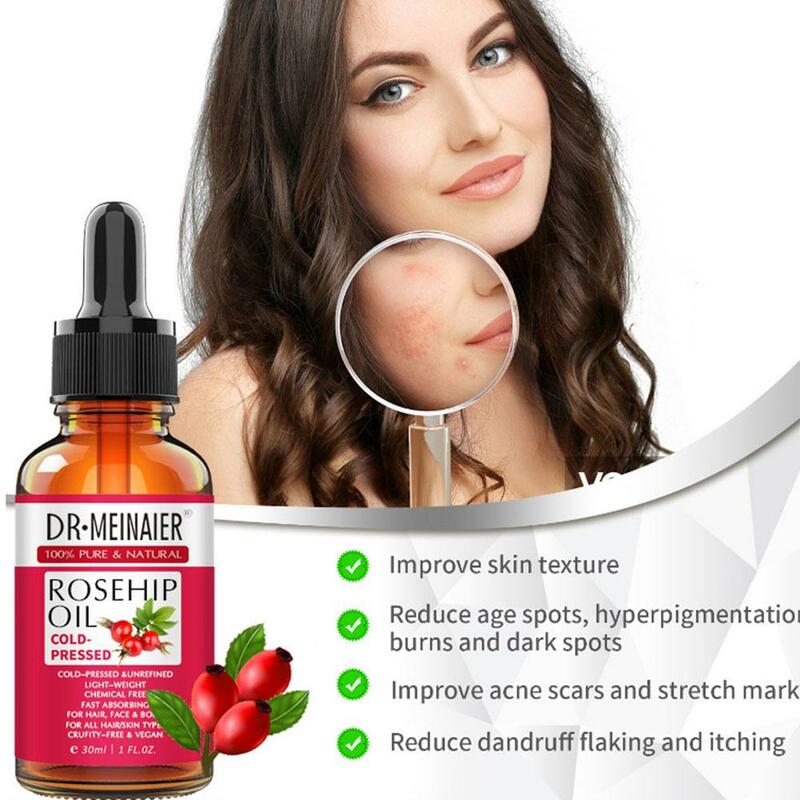Hagebutte ätherisches Öl natürliches reines Öl für Gesicht Anti-Aging Anti-Falten-Serum Feuchtigkeit creme Parfums Massage Hautpflege 30ml l5e5