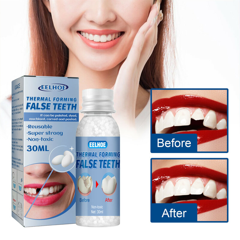 บรรจุฟันกาวกาวกันน้ำทันตแพทย์ฟันบรรจุหลุมฟิลเลอร์ Fix Kit กันน้ำและปลอดภัยฟันวีเนียร์ช่องว่างซ่อมฟัน