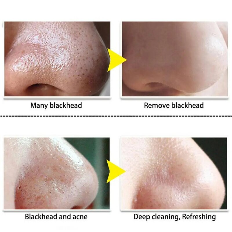 Środek do usuwania zaskórników LANBENA kremowe papierowe paski porów przeciwtrądzikowe na nos oczyszczające czarne kropki odklejają się błotna maska zabiegach do pielęgnacji skóry