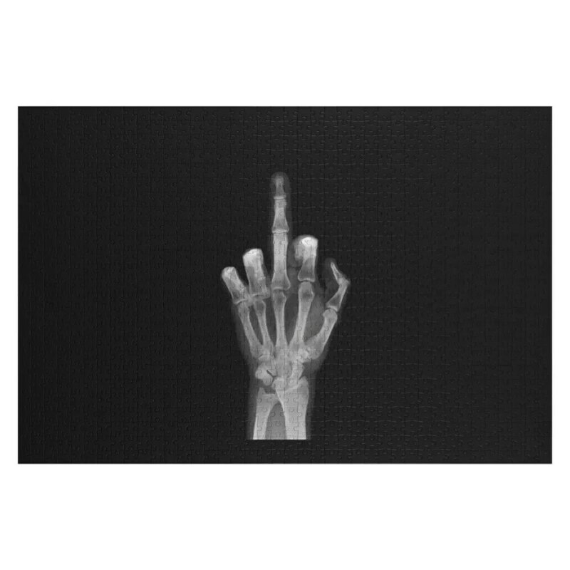 Пазл с изображением рентгена, среднего пальца