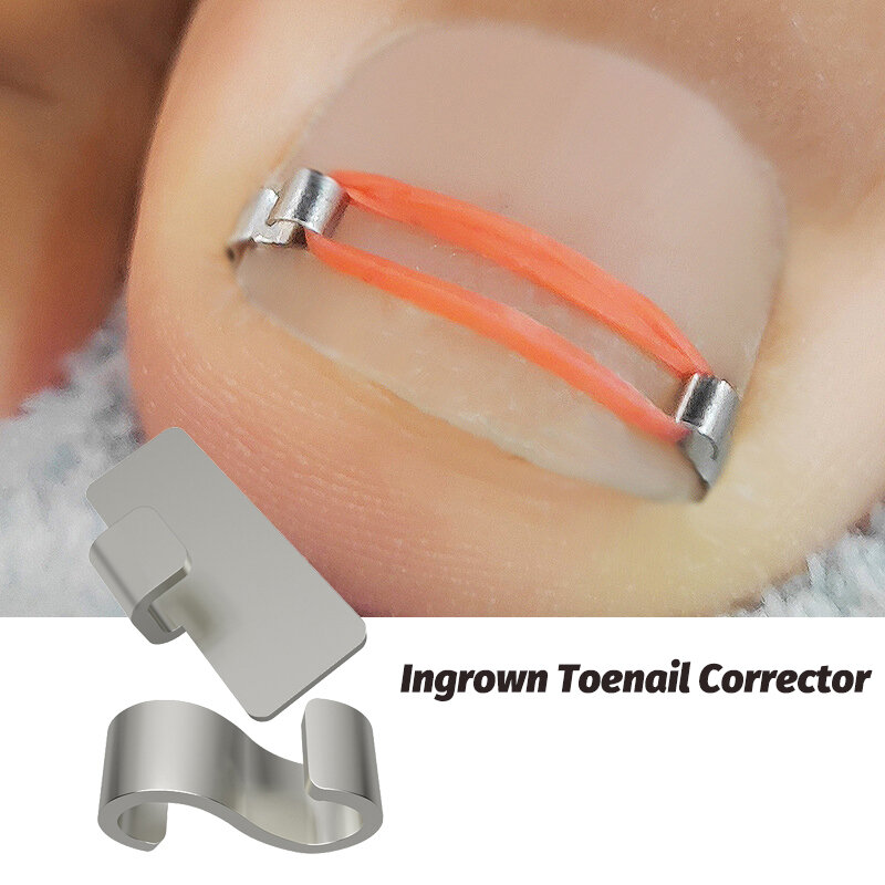 Ingrown Toenail Corrector Tools Pedicure Recover Embed Toe Nail Treatment Professional Ingrown Toenail Correction Foot Care Tool
