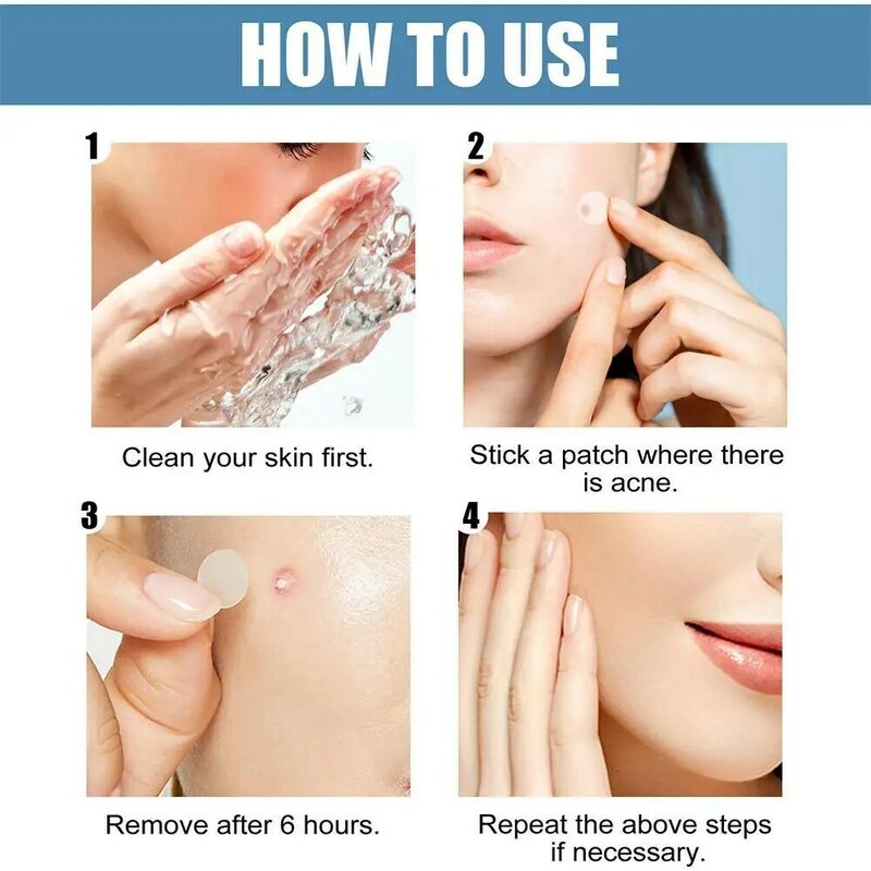 80pcs/set Large Size Acne Pimple Patch Face Treatment Invisible Tools Acne Remover Blemish Pimples Stickers D3T7