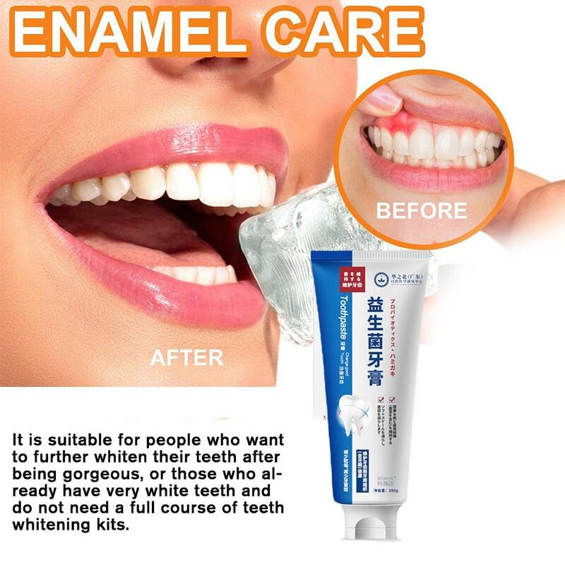 100G ซ่อมฟันผุซ่อมฟันคราบจุลินทรีย์ผุ Whitening สีเหลืองซ่อมฟันฟอกสีฟัน