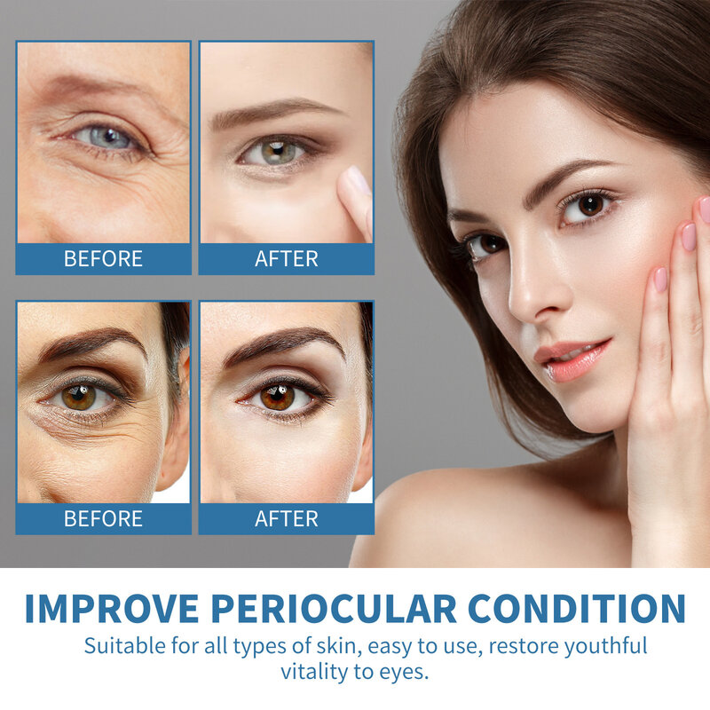 12pcs/Box Eye Gel Patch Reduce Wrinkles Eyes Dark Circles Eye Bags Moisturizing Anti-Wrinkle Eye Mask Patches With Hyaluronic